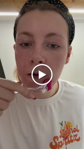 Customer video review of BEAUTYROLLER® - Microneedling für Gesicht & Dekolleté