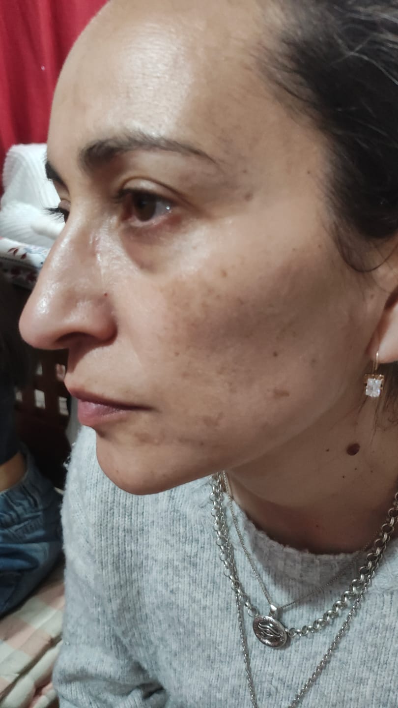 Customer photo review of Serum Activador