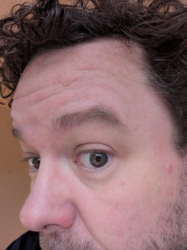 Customer photo review of Seb Natural Calming Serum