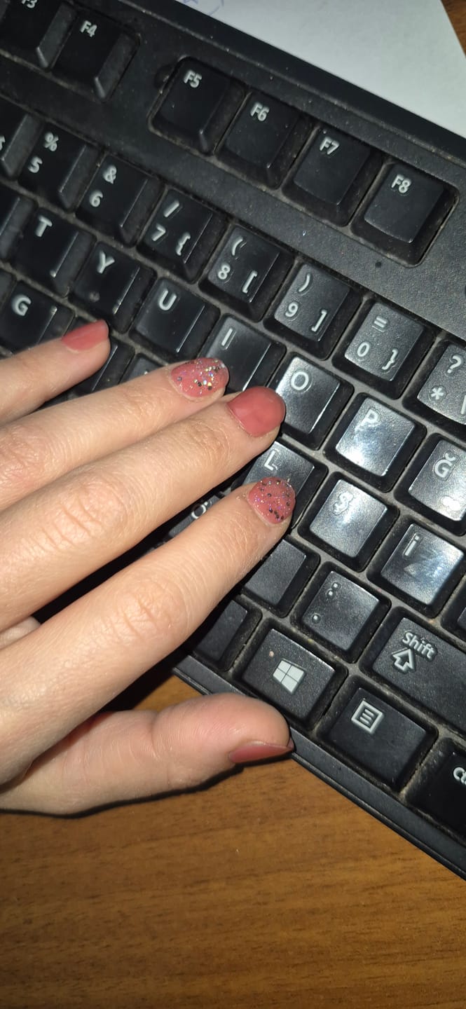 Customer photo review of N Addict Jel Tırnak 30 Adet, 2 Kullanım