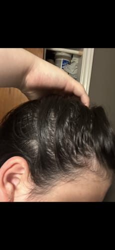 Customer photo review of Pre-Wash Fortifying Rosemary Oil for Scalp