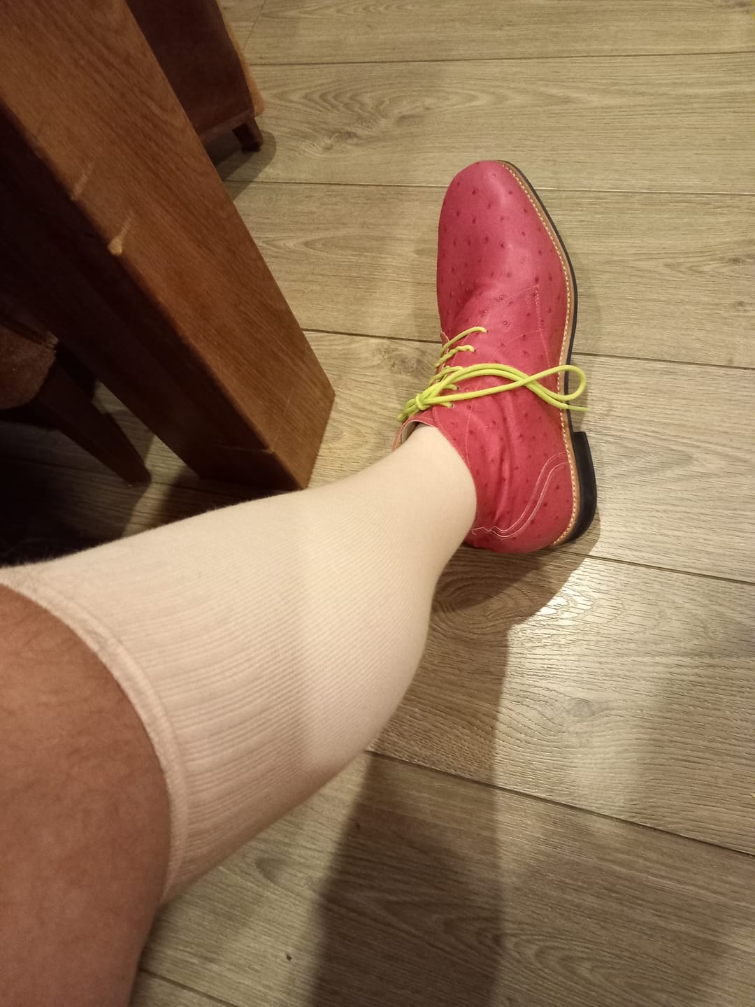 Customer photo review of Essential Compression Socks Pink