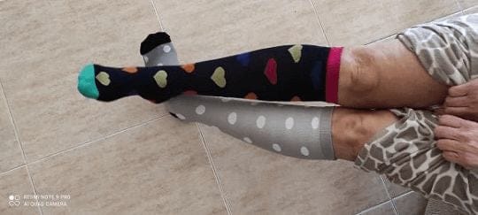 Customer photo review of Kompressionssocken für Damen