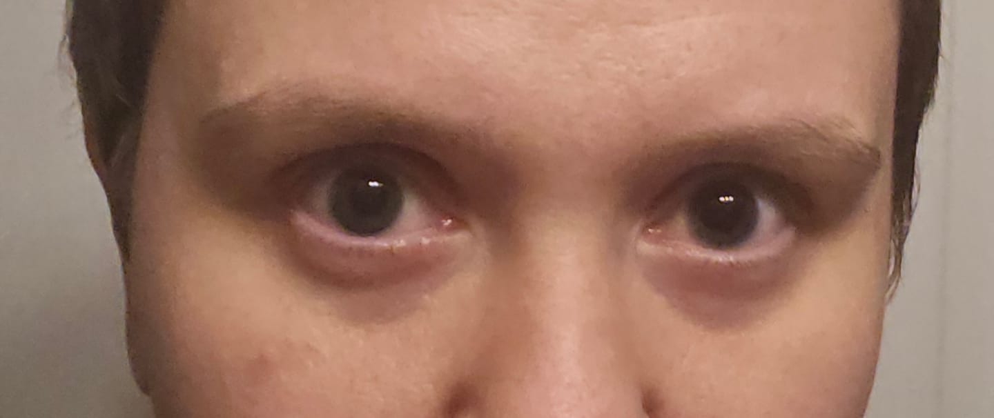 Customer photo review of Eyeling Grey