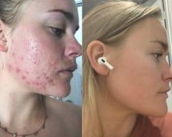 إيزابيلا ل. review of Skin-Brightening & Spot-Removing Tea image 1 out of 3