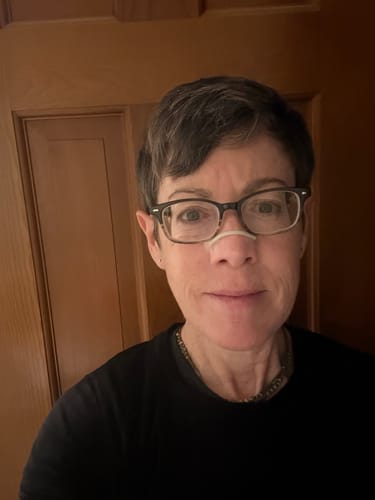 Customer photo review of Second Wind Nasal Strips