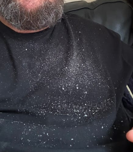 Customer photo review of Seb Natural Calming Serum