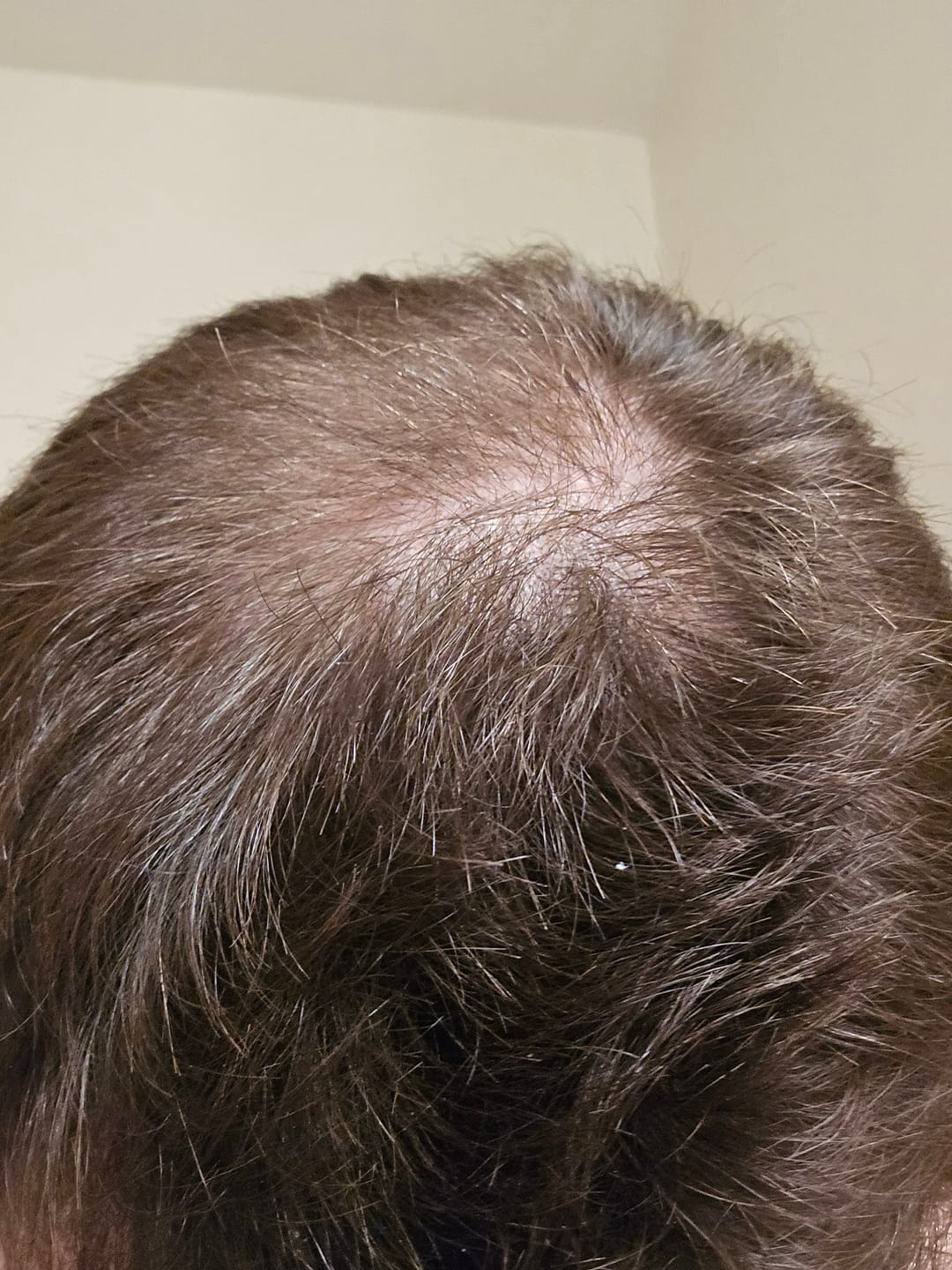 Customer photo review of Volumane Anti-Thinning Stimulating Shampoo