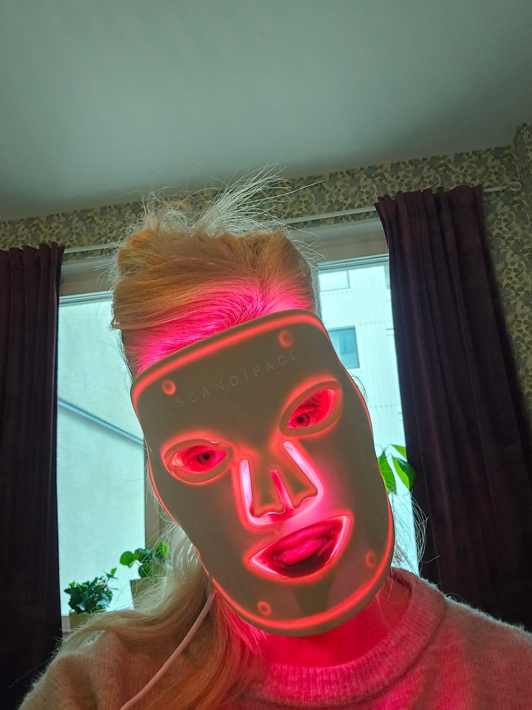 Customer photo review of Skinboosting LED mask