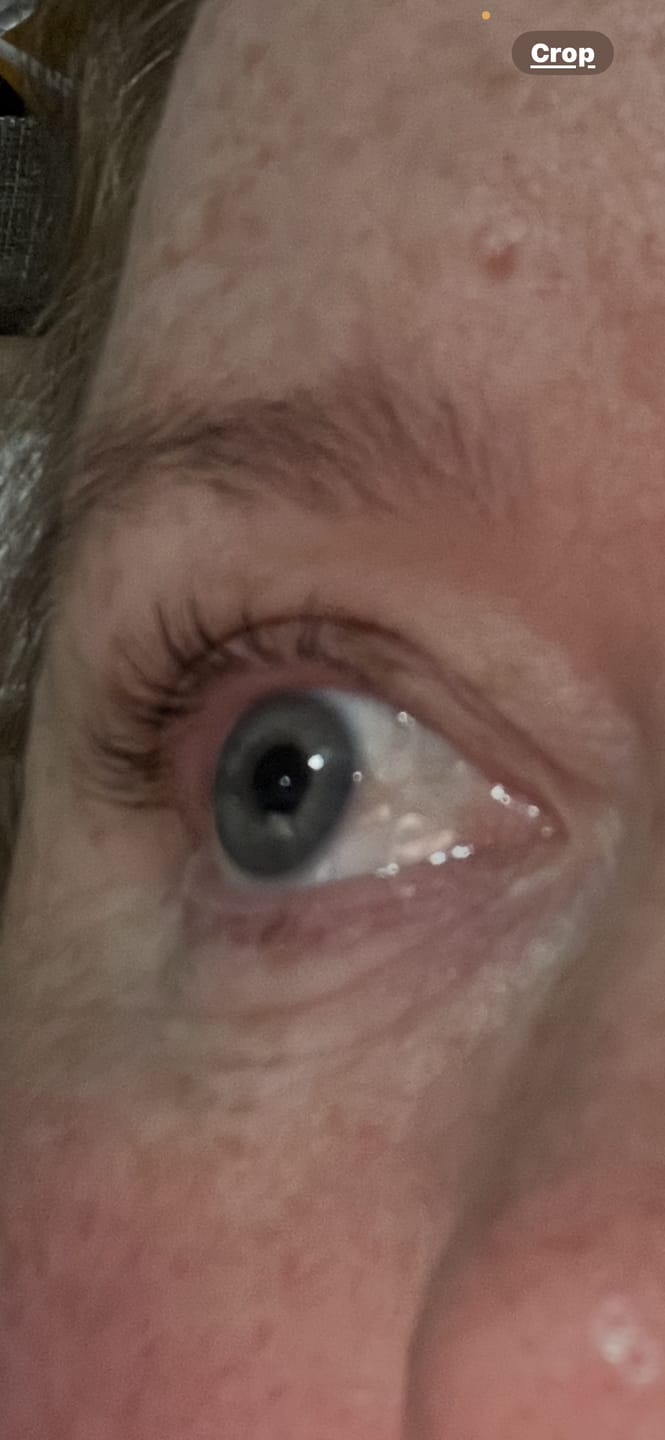 Customer photo review of Cysteamine Brow & Lash Lamination Kit - Step 2 - 15ml