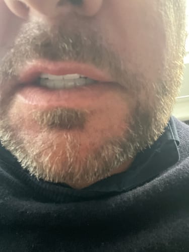 Mat R. review of Seb Natural Calming Serum image 1 out of 1