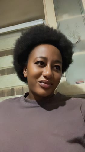 Customer photo review of Minoxidil High Strength (5%) SOLUTION, 3x60ml pack