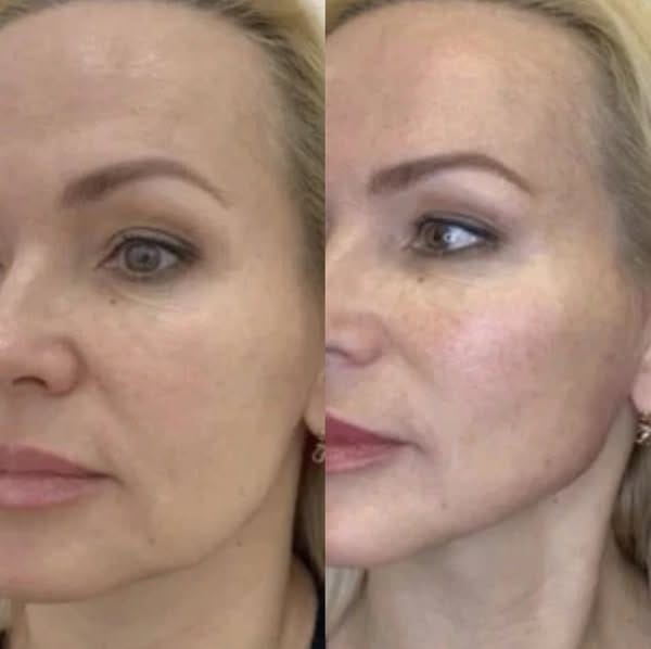 Customer photo review of CollaGlow - 30 Tage Kollagen-Kur