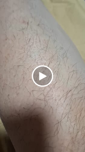 Customer video review of Depilador Nano Pro