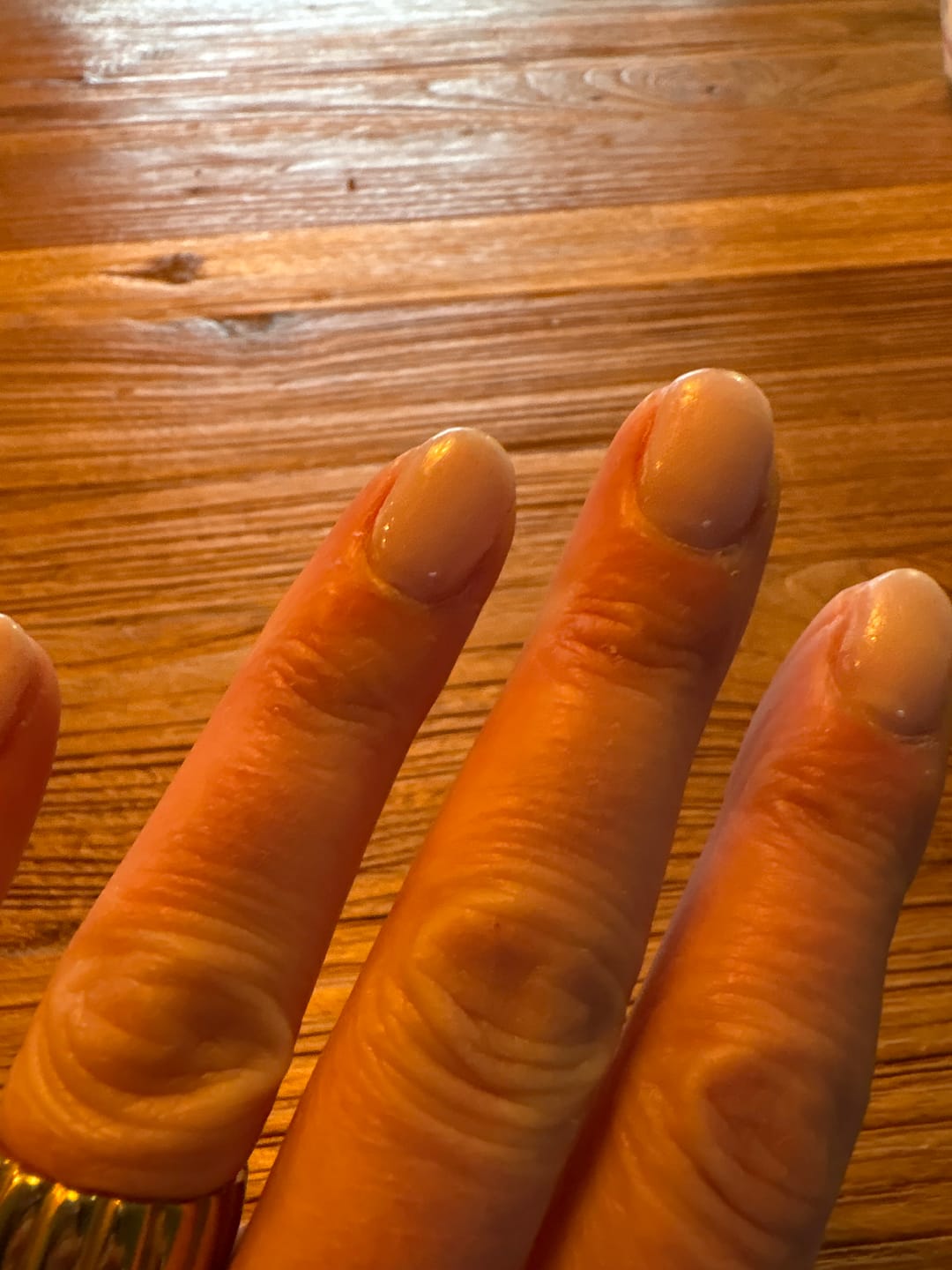 Customer photo review of Peel Off Base Coat