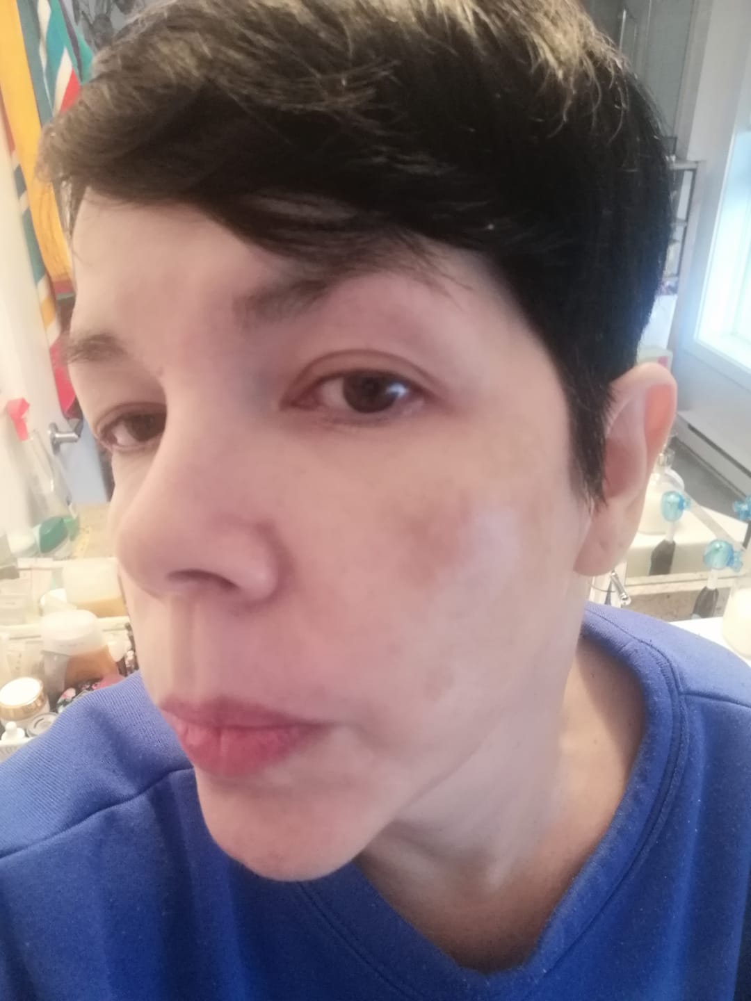 Customer photo review of Madeca derma mask III Intensive Formula 23ml*10p