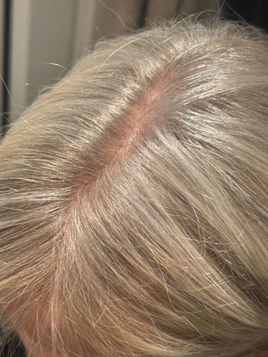 Damon R. review of Sunkissed Starter Kit image 1 out of 2