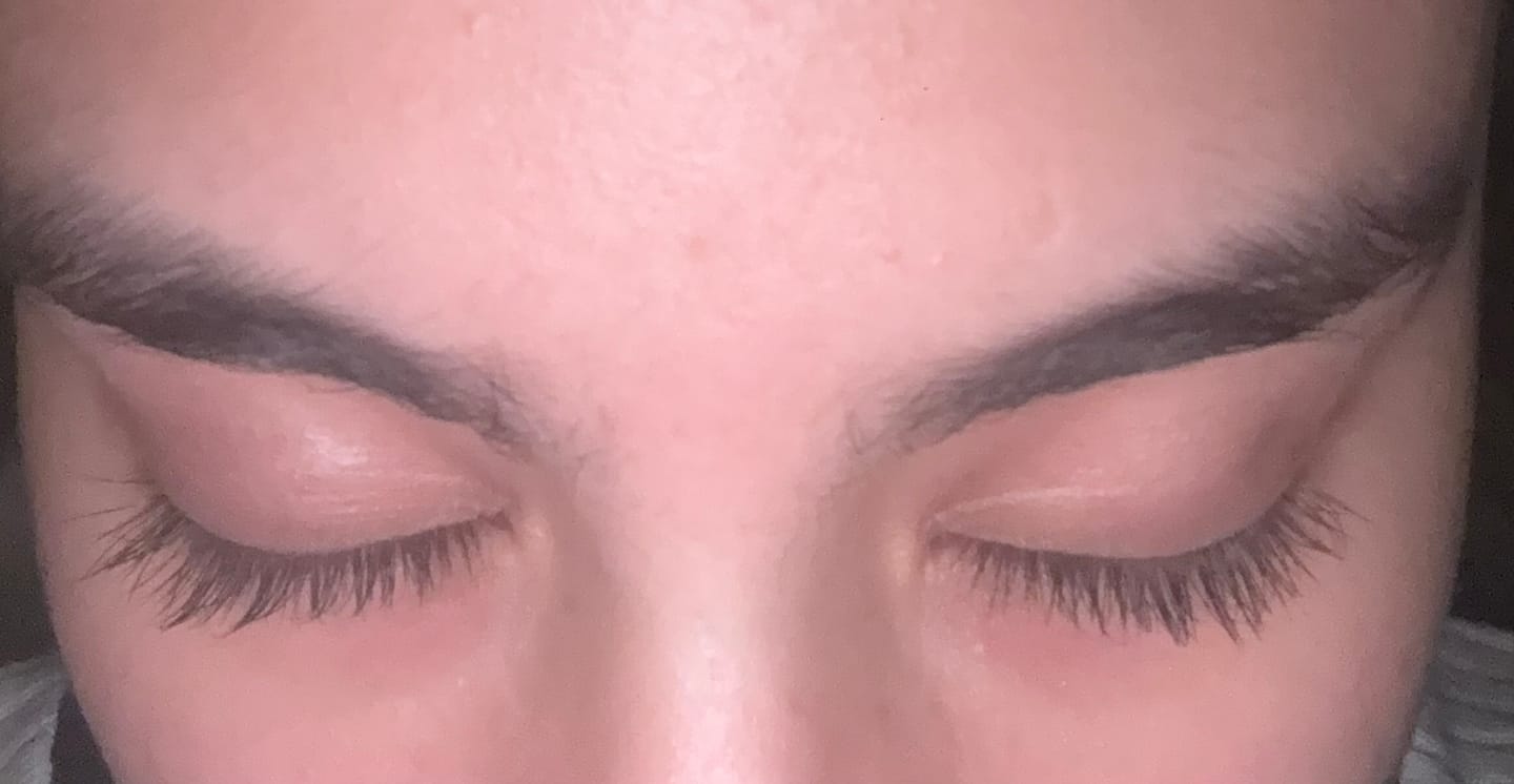 Customer photo review of LV CHAMPS EYELASH SERUM