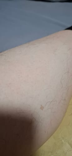 Customer photo review of Depilador Nano Pro