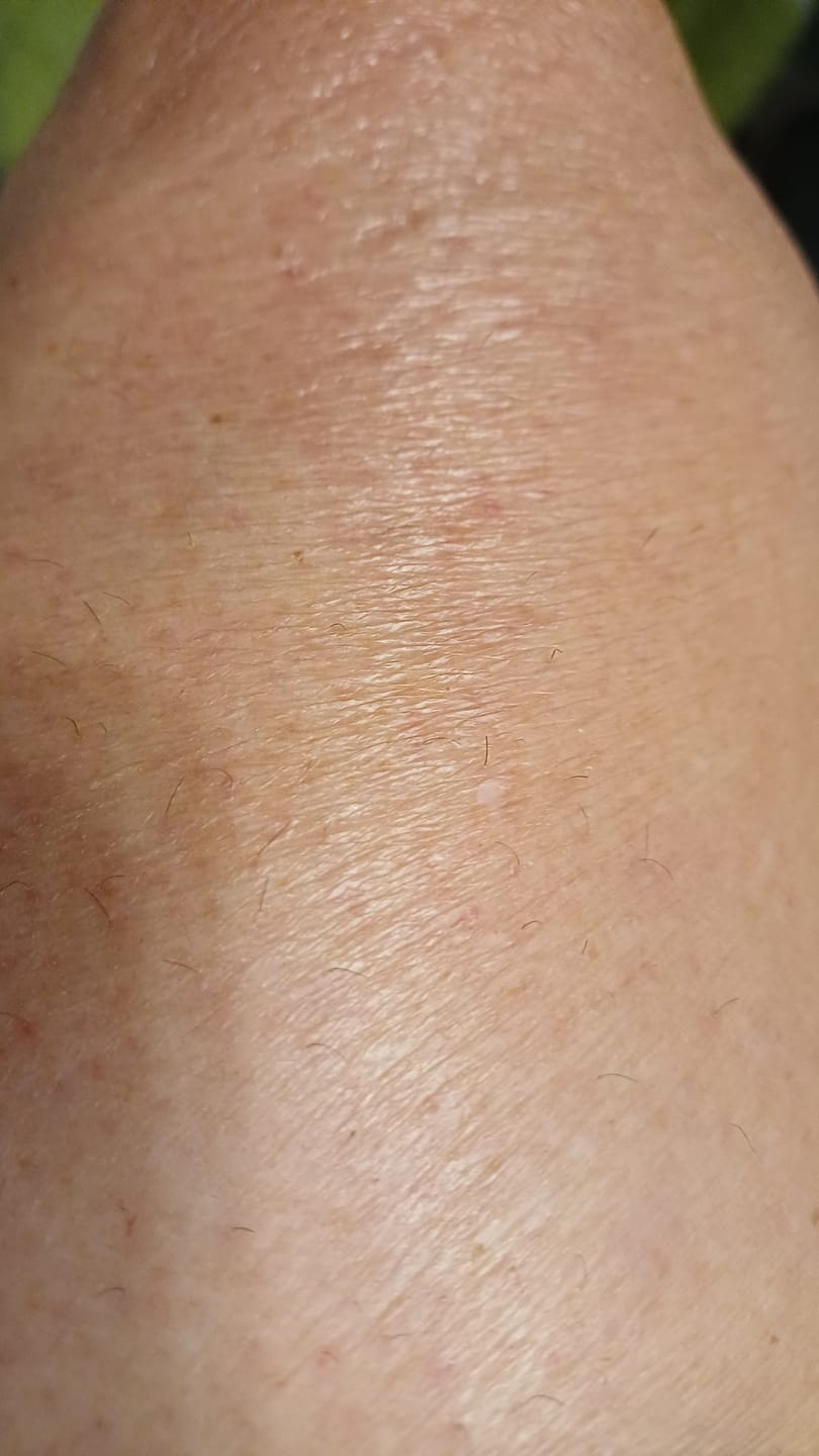 Customer photo review of Anti Haarwachstum Serum