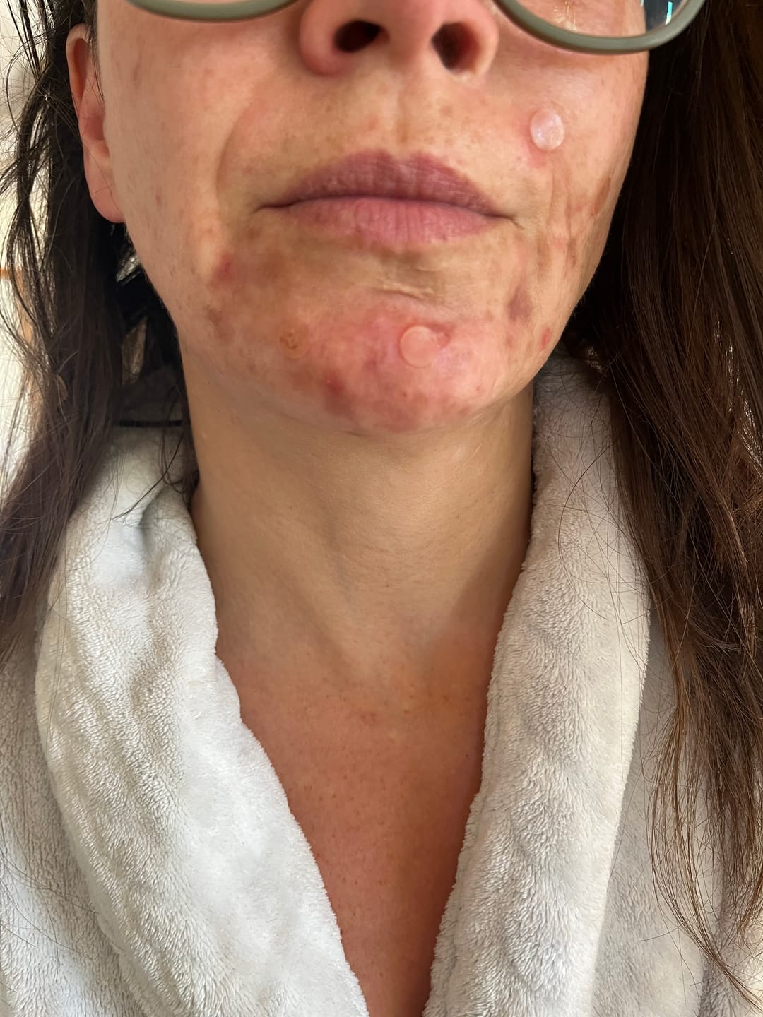 Customer photo review of Spot Treatment