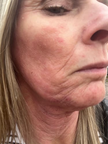 Customer photo review of Seb Natural Calming Serum