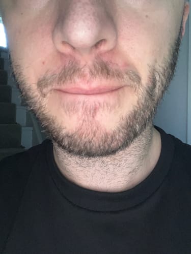 Customer photo review of Seb Natural Calming Serum