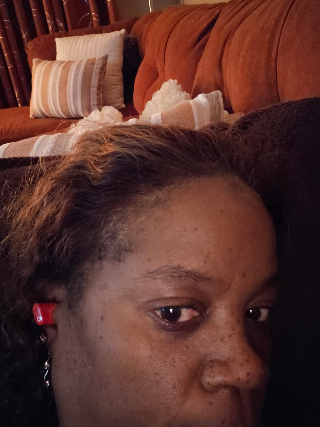 Customer photo review of Hold Me Down™ Adhesive Skin Guard (Ain’t No Other™)