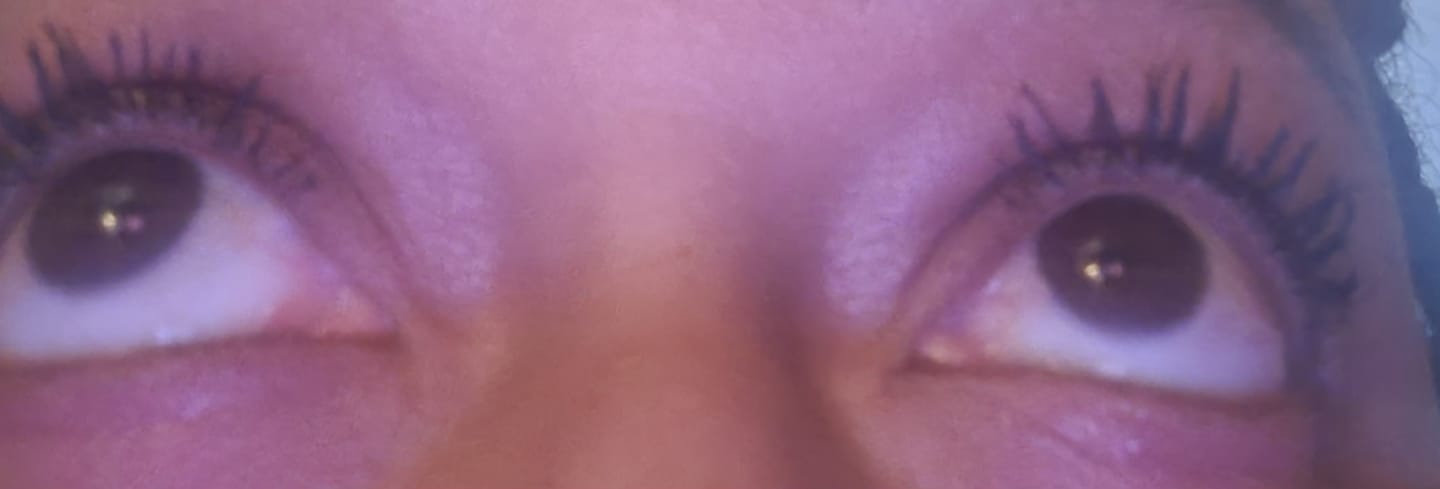 Customer photo review of Volume Eyebrow and Eyelash Serum -