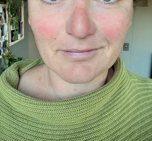 Customer photo review of Exfoliating Cream