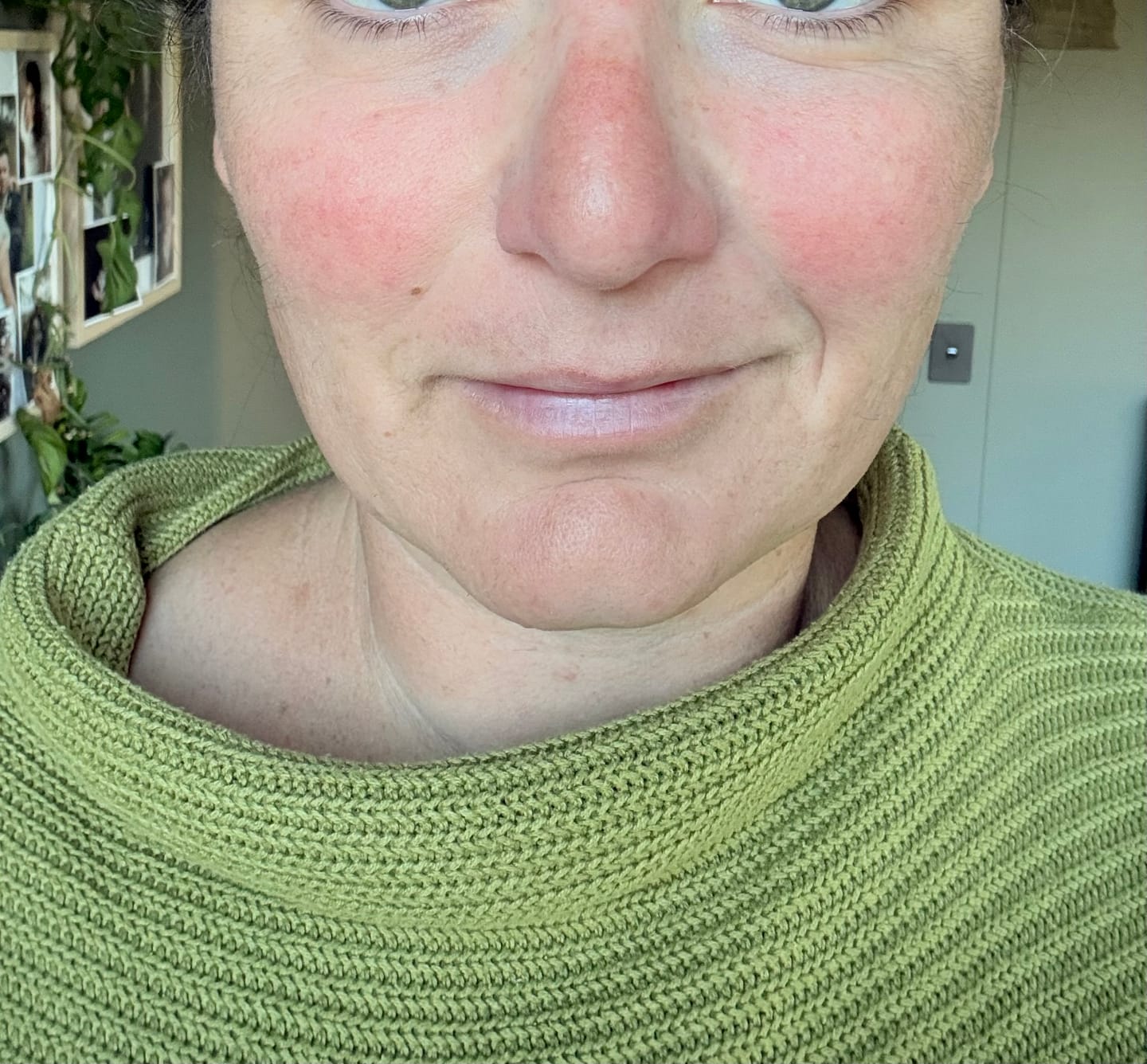 Customer photo review of Exfoliating Cream