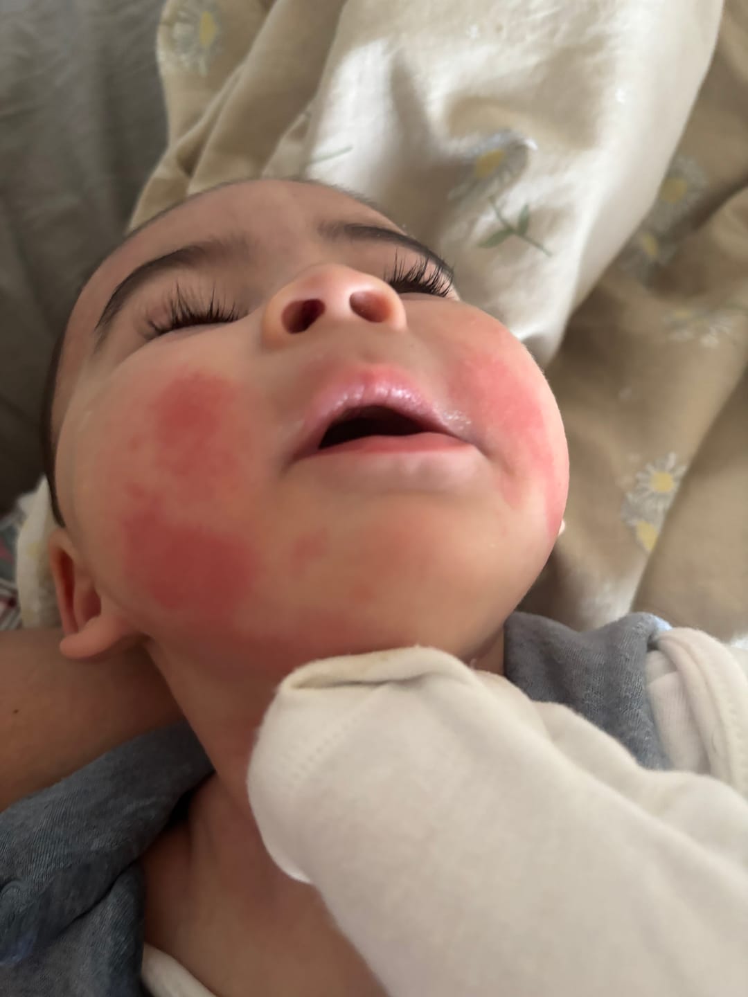 Customer photo review of Large Bioskin Junior Duo Pack