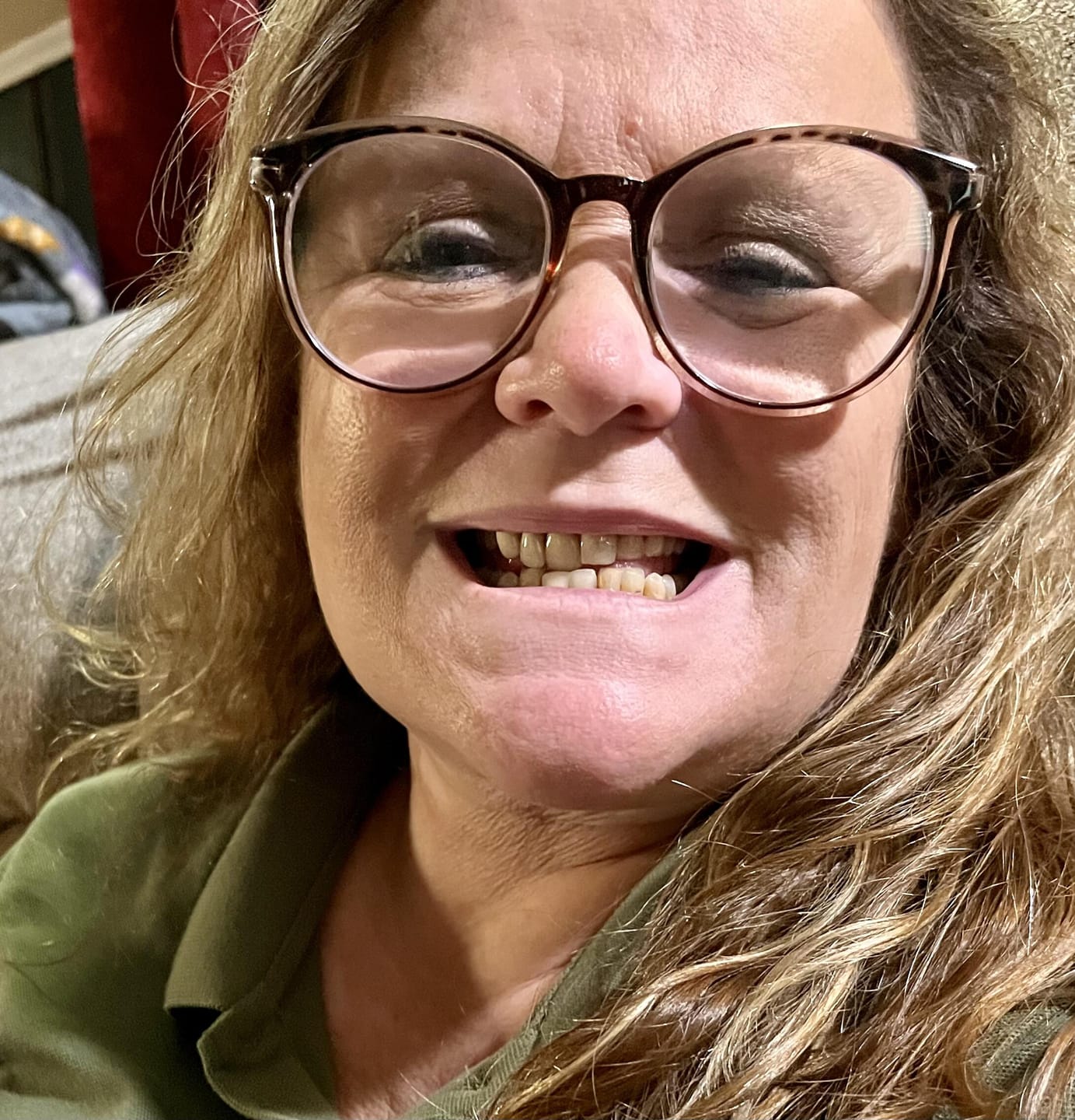 Customer photo review of Unilateral Partial Denture