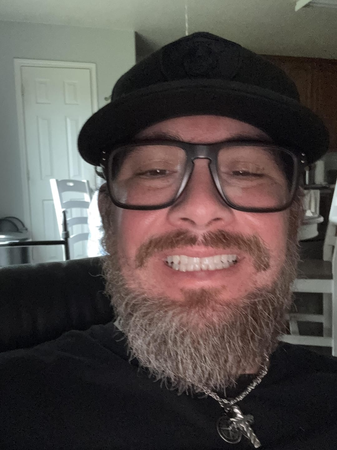 Customer photo review of Flexible Partial Denture