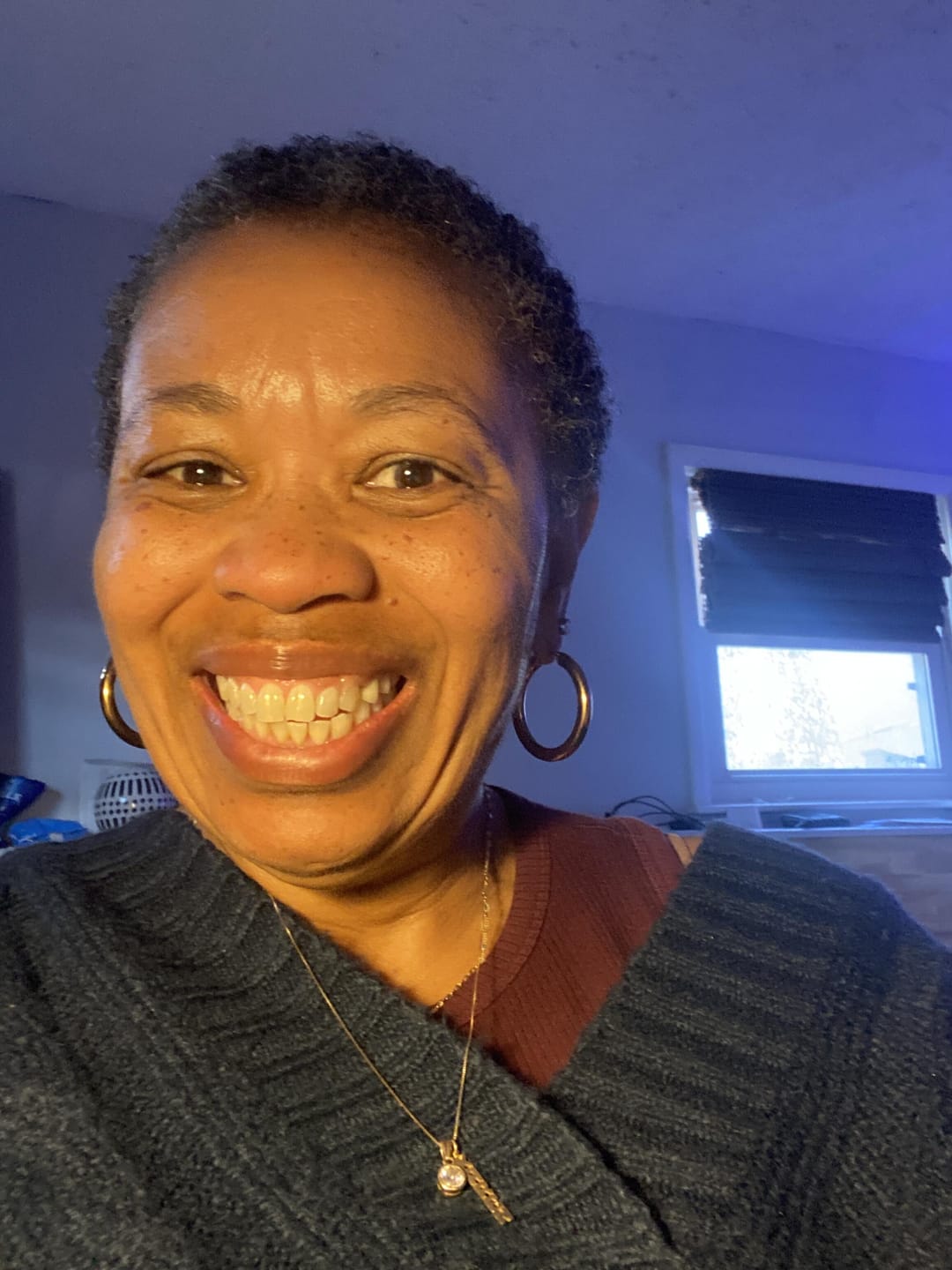 Customer photo review of Flexible Partial Denture