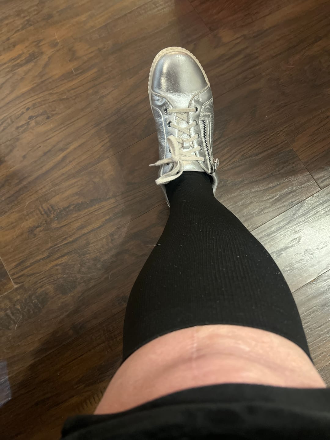 Customer photo review of Everstride™ Original Wide Compression Socks