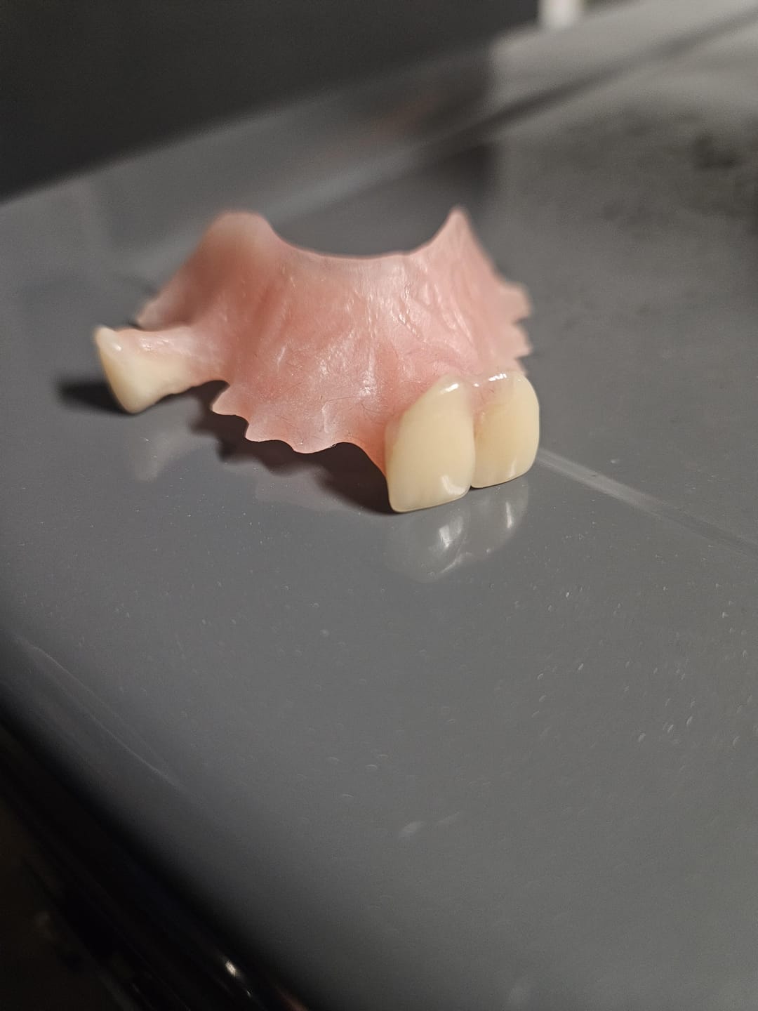 Customer photo review of Acrylic Partial Flipper Denture