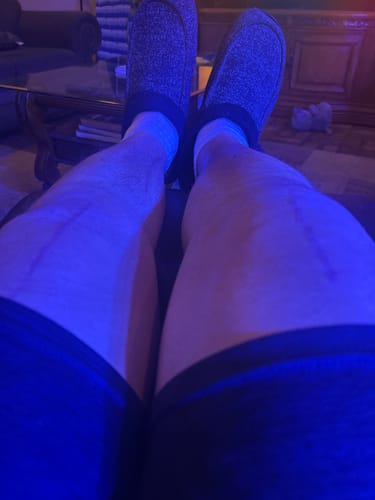A reviewer's legs with visible scars from a double knee replacement, as mentioned in their review.
