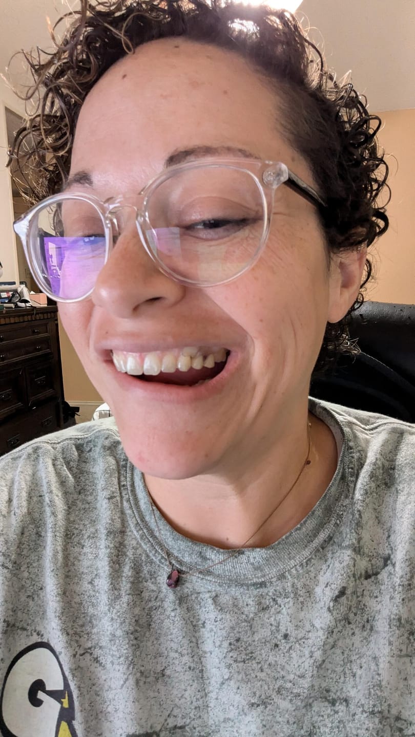 Customer photo review of Clear Unilateral Partial Denture