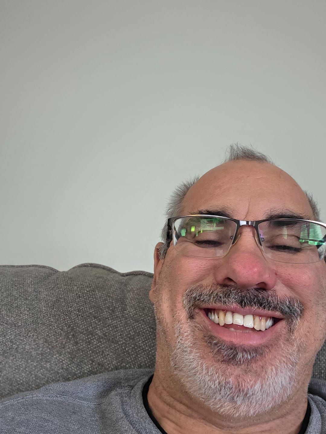 Customer photo review of Flexible Partial Denture