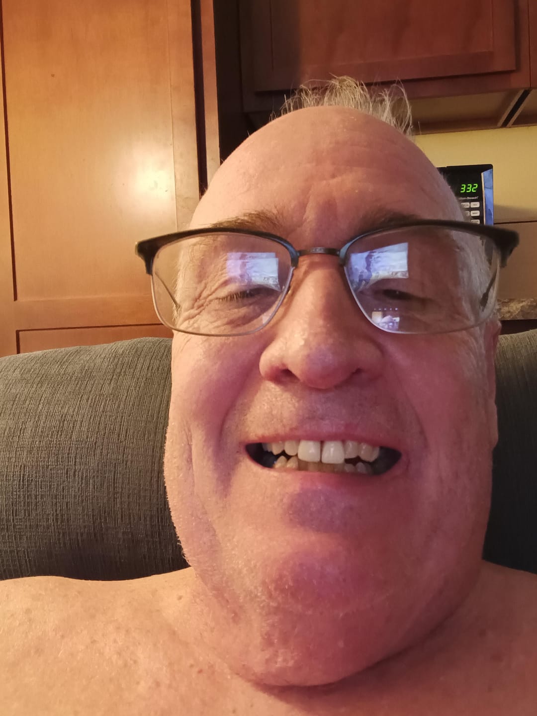 Customer photo review of Acrylic Partial Flipper Denture