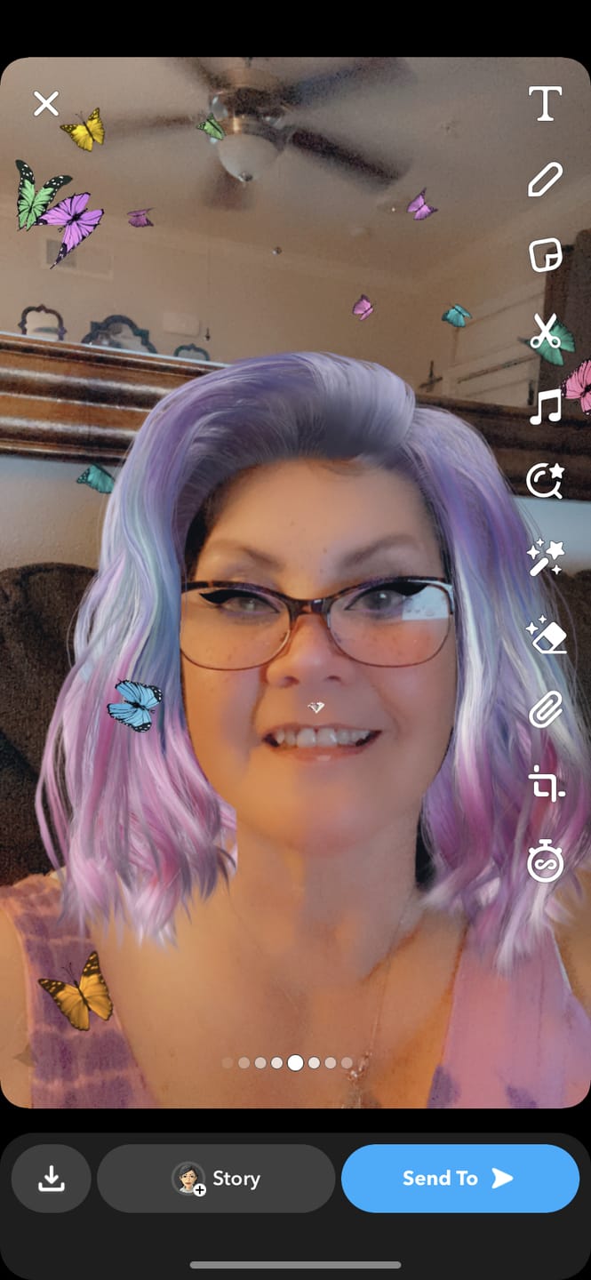 Customer photo review of Flexible Partial Denture