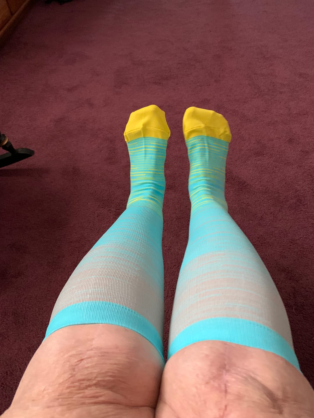 Customer photo review of The Step by Step Guide To Transforming Your Leg Health