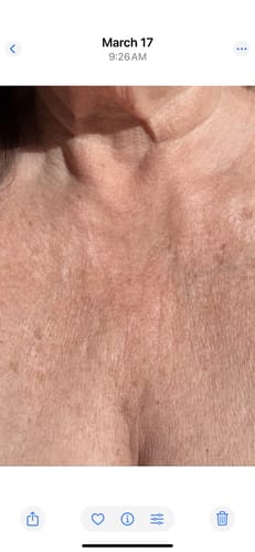 Customer photo review of Besque™ Magic Body Oil - 100ml