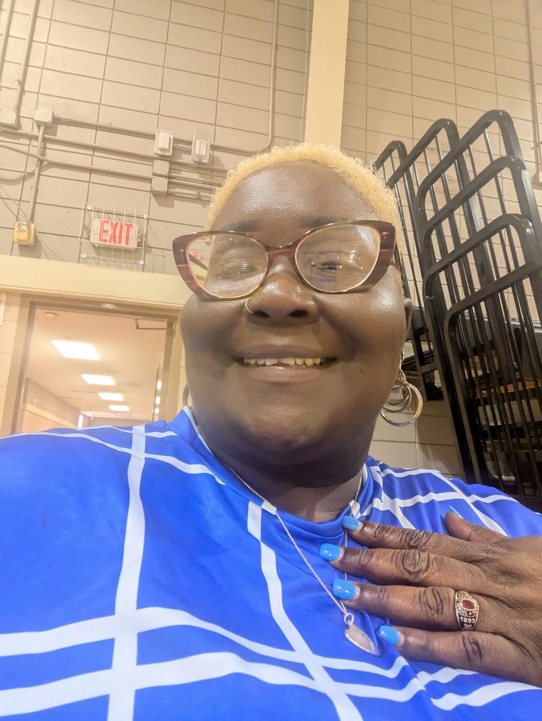 Customer photo review of Clear Flexible Partial Denture