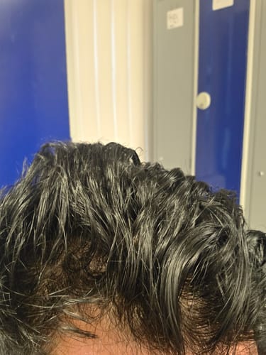 Customer photo review of Seb Natural Calming Serum