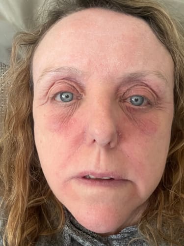 Customer photo review of Seb Natural Calming Serum