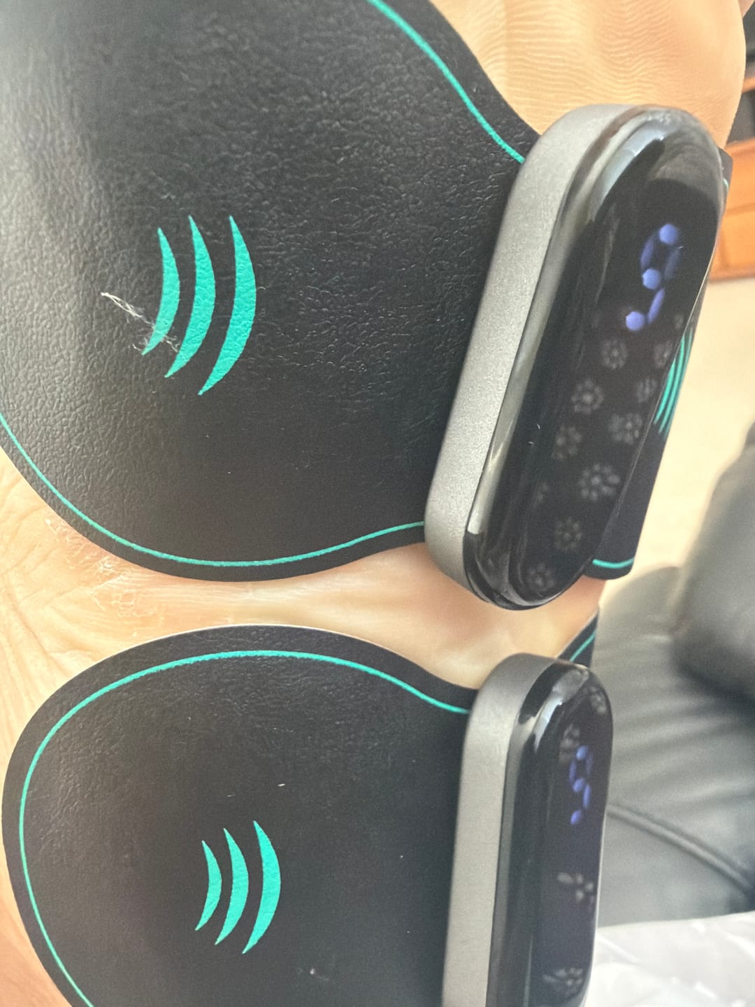 Customer photo review of Vibit TENS - Electrical Nerve Stimulation Therapy