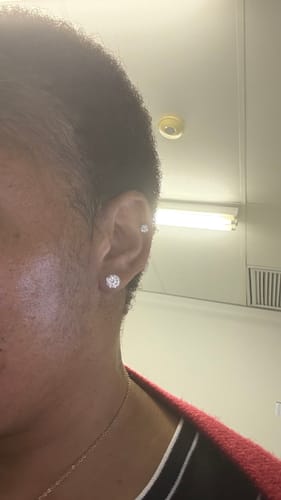 Customer photo review of Minoxidil High Strength (5%) SOLUTION, 3x60ml pack