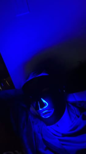 Customer photo review of INIA GLOW Wireless Red Light Therapy Mask